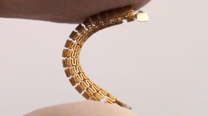 Các stent thông minh có chứa một chip cảm biến và vật liệu tương thích sinh học và trông tương tự như hầu hết các stent thông thường.
