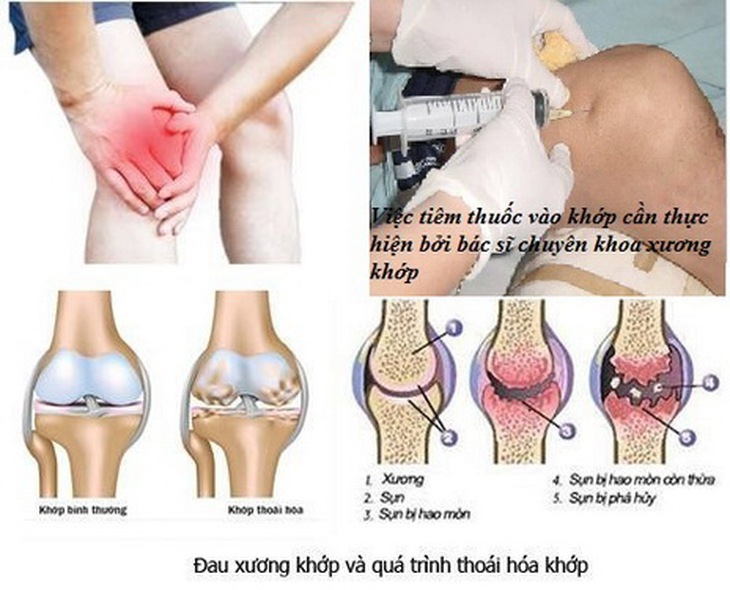 Đau khớp và quá trình thoái hóa khớp.