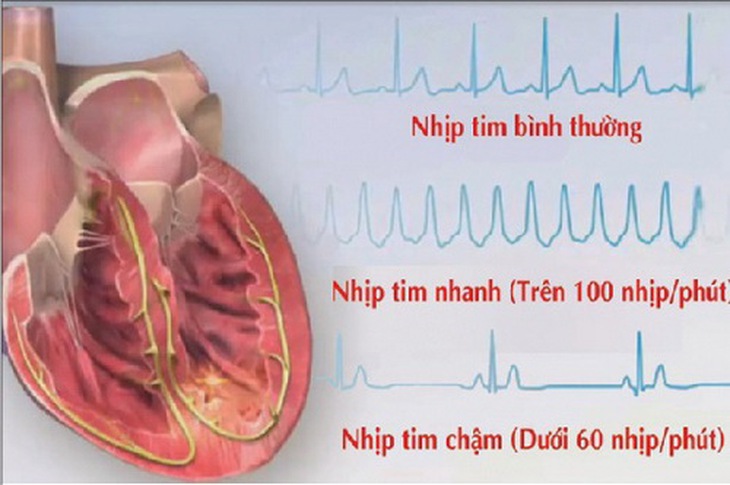 Nhịp tim chậm.