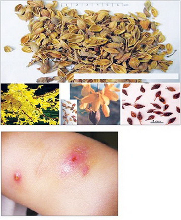 Liên kiều (quả của cây liên kiều) thanh nhiệt giải độc, trị mụn nhọt.