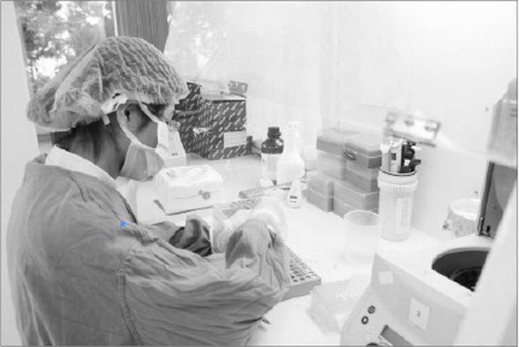 Xét nghiệm phát hiện lao. Ảnh: TM