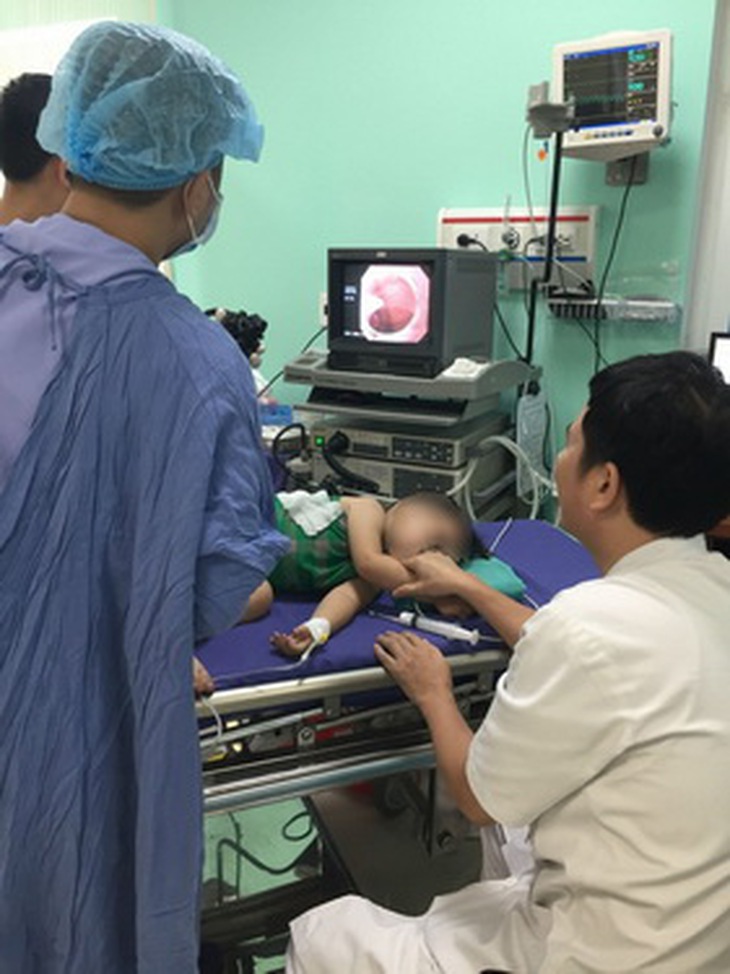 Soi đại trực tràng cho trẻ em.