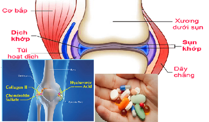 Cảnh giác với bất lợi của thuốc “bổ khớp”.