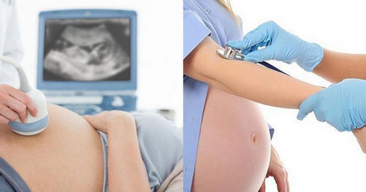 Giang mai ảnh hưởng nghiêm trọng đến sức khỏe bà mẹ và trẻ sơ sinh.