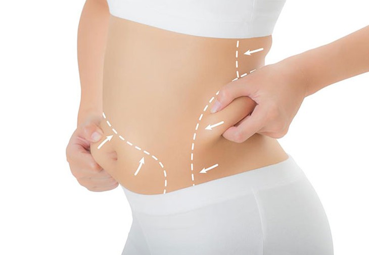 Hút mỡ bụng có ảnh hưởng gì?