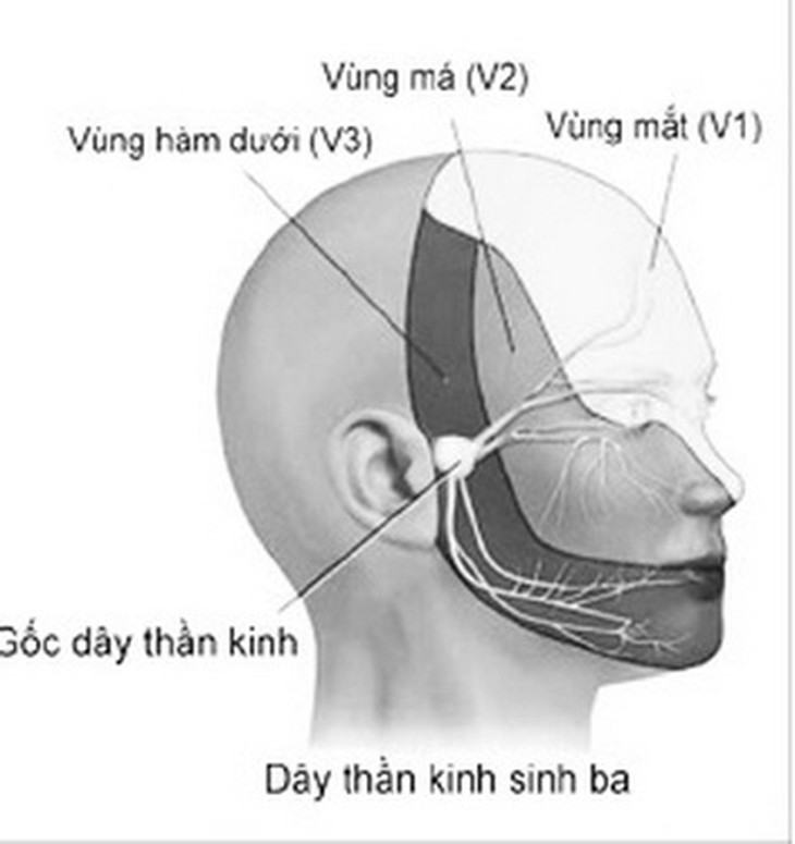 Dây V được hợp thành từ 3 nhánh thần kinh là V1 - V2 - V3, mỗi nhánh nhỏ này cảm giác cho một phần của nửa mặt.