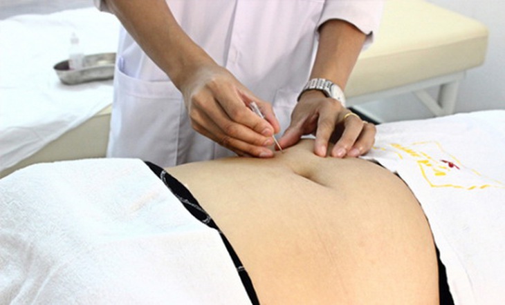 Cấy chỉ giúp khí huyết lưu thông, điều hoà công năng.