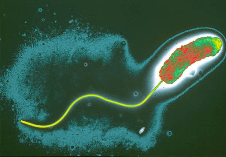 Hình ảnh vi khuẩn Vibrio cholerae.