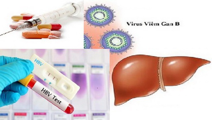 Viêm gan B là bệnh khá phổ biến trong cộng đồng.