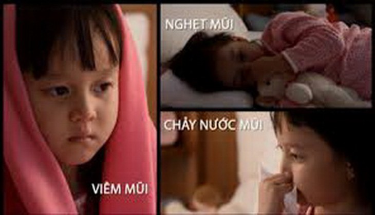 Một số triệu chứng khi bị viêm mũi dị ứng.