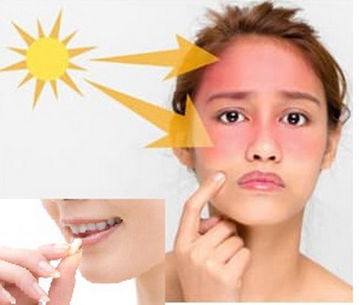 Một số thuốc khiến da bị nám do nhạy cảm ánh sáng.