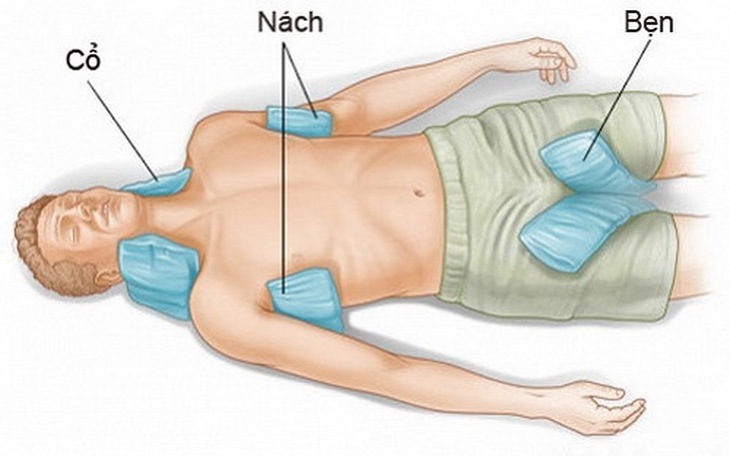 Chườm mát vào trán, gáy nách bẹn.