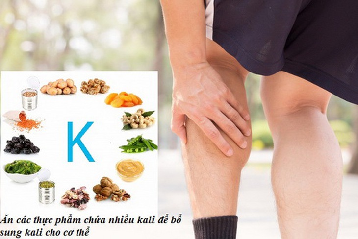 Chuột rút là một trong những biểu hiện của thiếu kali.