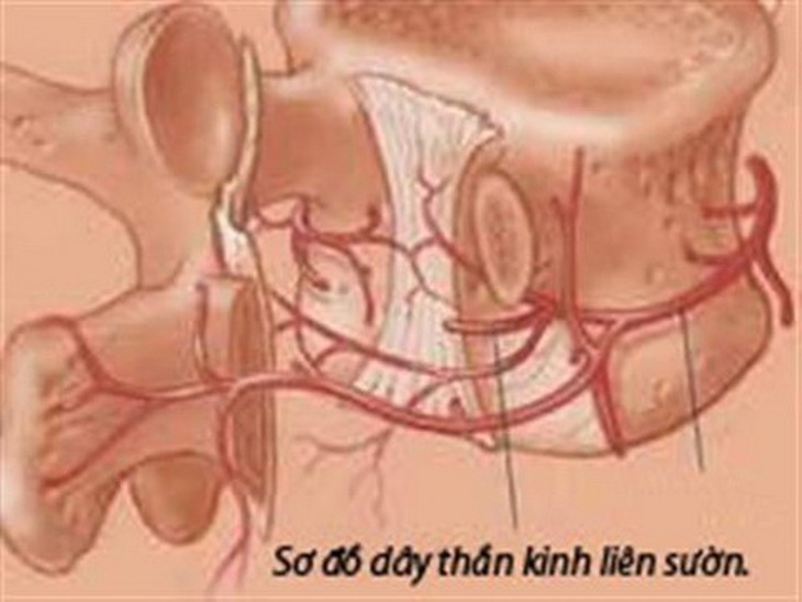 Cần lưu ý tới các tác dụng phụ khi dùng thuốc trị đau dây thần kinh liên sườn.