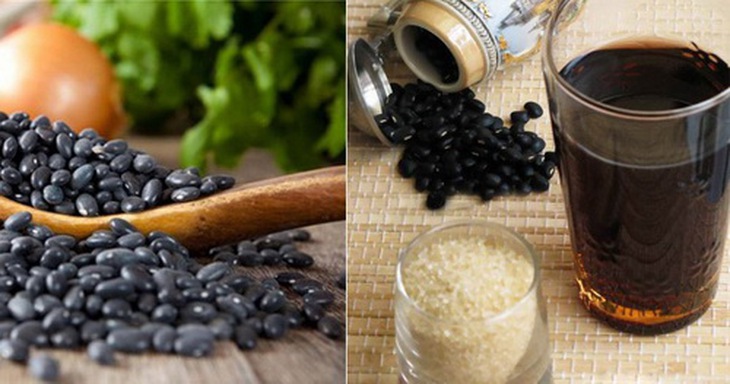Nước đậu đen rất tốt cho người phù nề nặng cả ở hai chân và bụng.