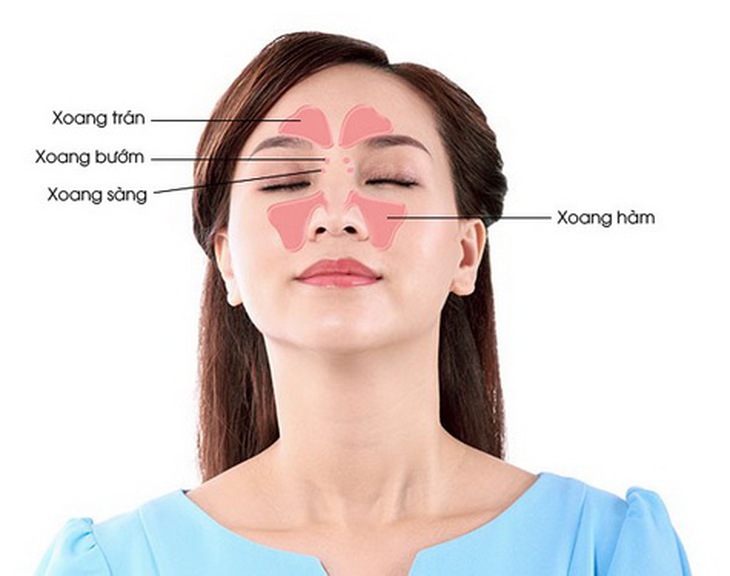 Viêm xoang cấp tính nếu không được điều trị sẽ dẫn đến viêm tai giữa, viêm phế quản phổi hoặc tiến triển thành viêm xoang mạn.