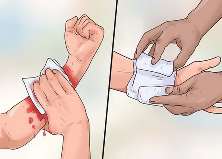 Vi trùng uốn ván xâm nhập cơ thể qua vết thương.
