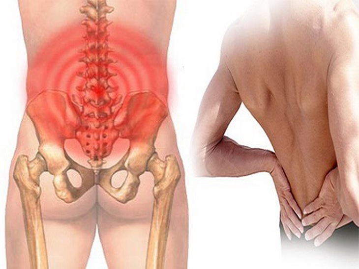 Nắm véo cơ hai bên cột sống thắt lưng giúp thư giãn cơ, giảm đau lưng.