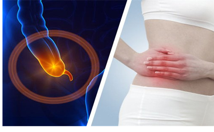 Dấu hiệu viêm ruột thừa cấp