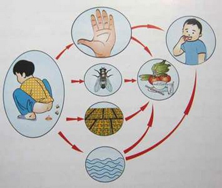 Lỵ trực khuẩn lây qua đường tiêu hóa, do vi khuẩn Shigella gây ra.