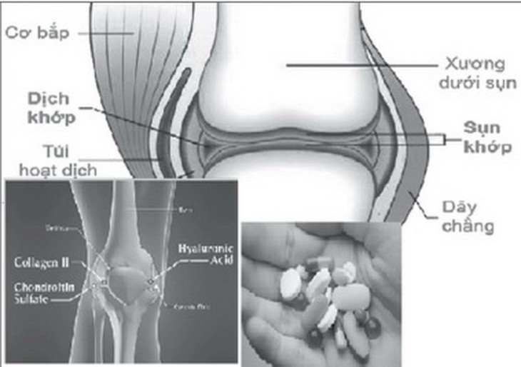 Người bệnh khớp thận trọng khi dùng thuốc.