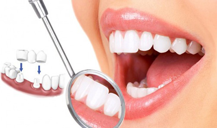 Làm gì khi bị tụt lợi?