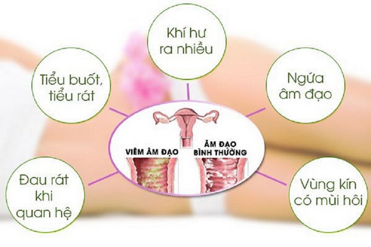 Dấu hiệu nhận biết viêm âm đạo.
