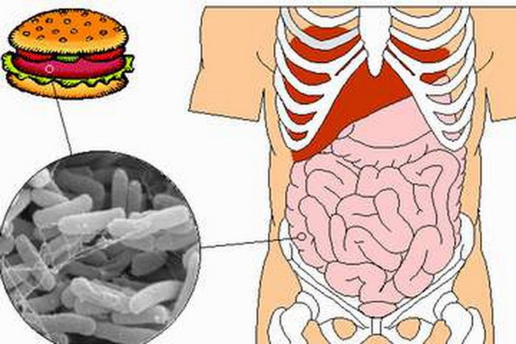 Bệnh lỵ trực khuẩn là bệnh nhiễm khuẩn đường ruột cấp tính do trực khuẩn Shigella gây ra.