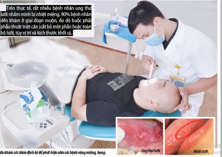 Phân biệt nhiệt miệng và ung thư lưỡi