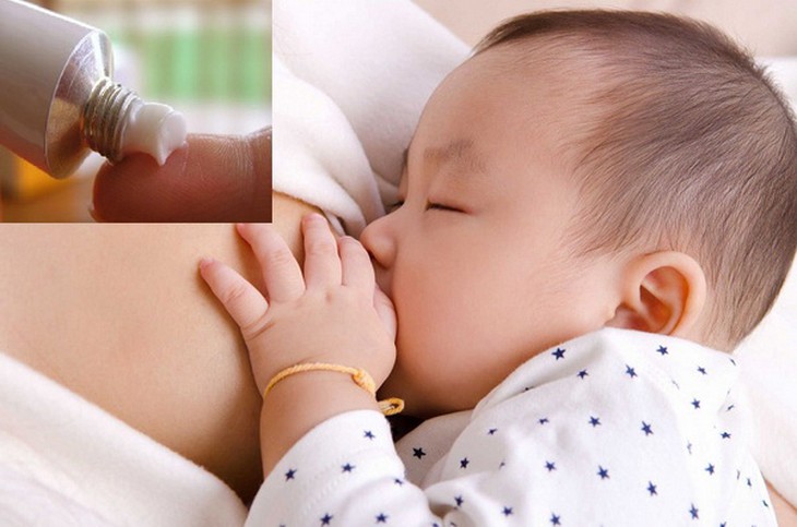 Nên ưu tiên dùng thuốc tại chỗ khi có thể đối với phụ nữ cho con bú.