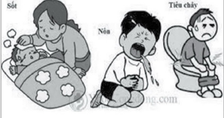Biểu hiện tiêu chảy cấp do nhiễm khuẩn ở trẻ.
