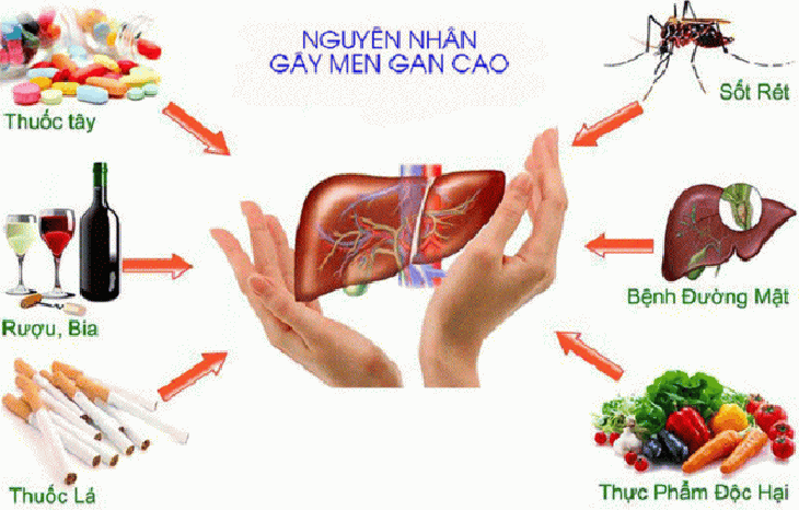 Một số yếu tố khiến men gan tăng cao.