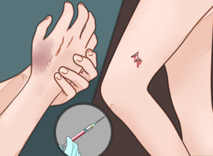 Dấu hiệu nhận biết bệnh uốn ván