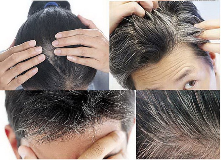 Đậu tương chữa tóc bạc sớm.