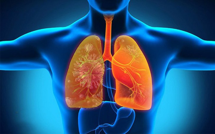 Triệu chứng bệnh bụi phổi