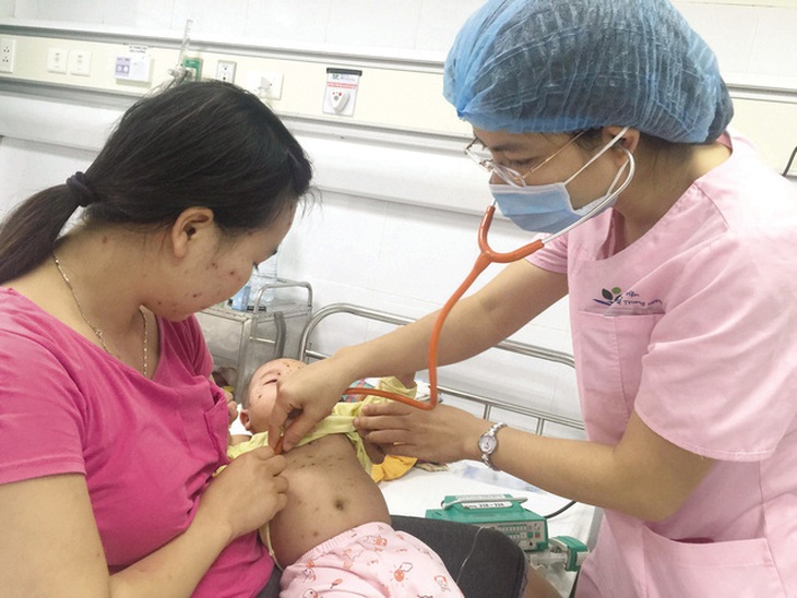 Cần đặc biệt chú ý chăm sóc khi trẻ mắc thủy đậu.