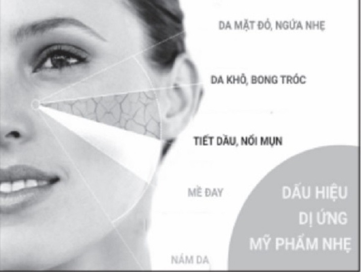 Dấu hiệu da bị dị ứng mỹ phẩm nhẹ.