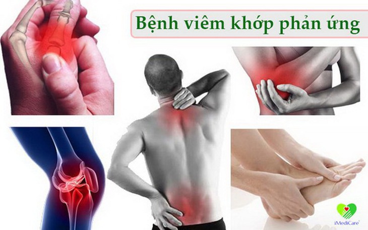 VKPƯ thường xảy ra nhất ở đầu gối, mắt cá chân, bàn chân, gót chân, lưng...