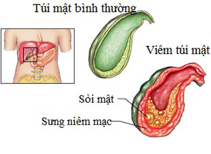 tui mat