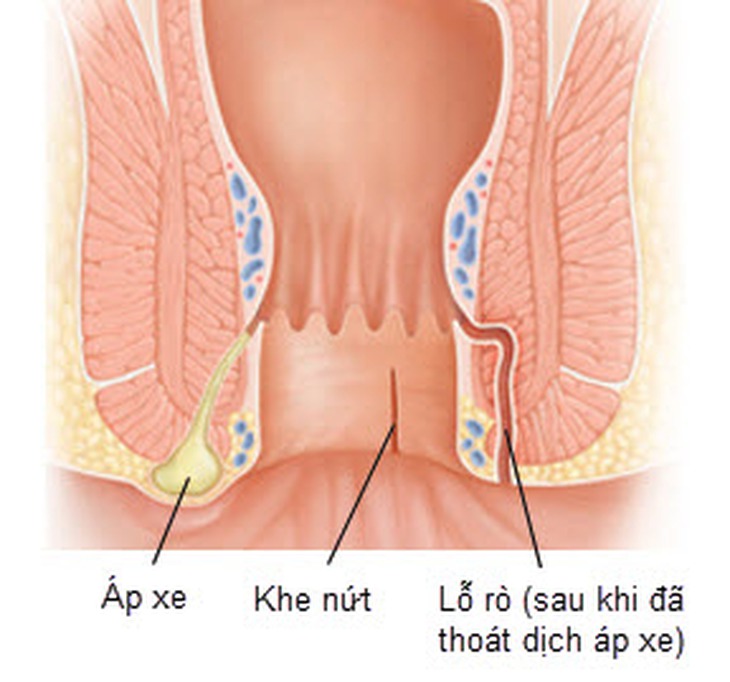ngua hau mon