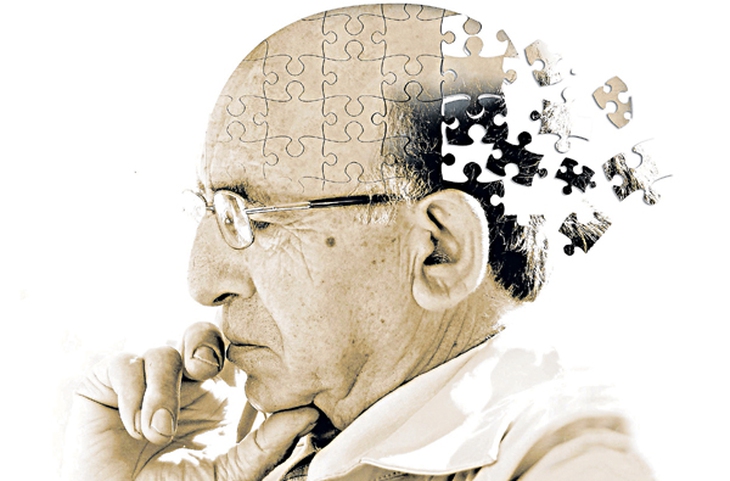 Alzheimer