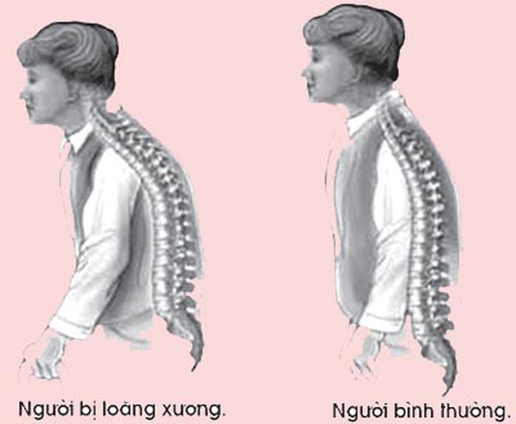 xuong khop