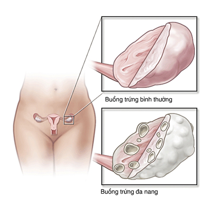 buong trung da nang