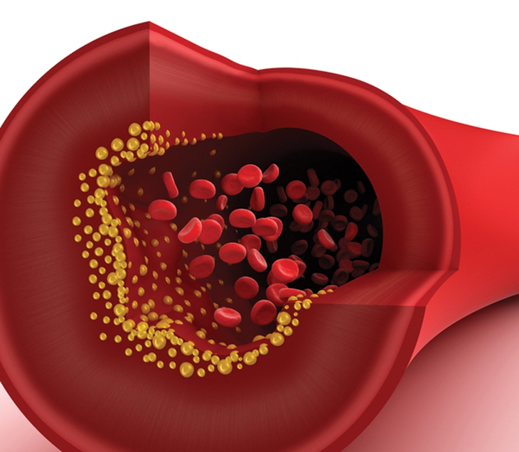 táo hỗ trợ điều trị cholesterol máu cao