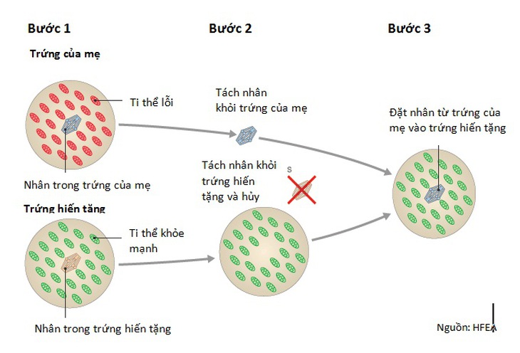 Phương pháp IVF “ba bố mẹ” giúp ngăn ngừa bệnh di truyền