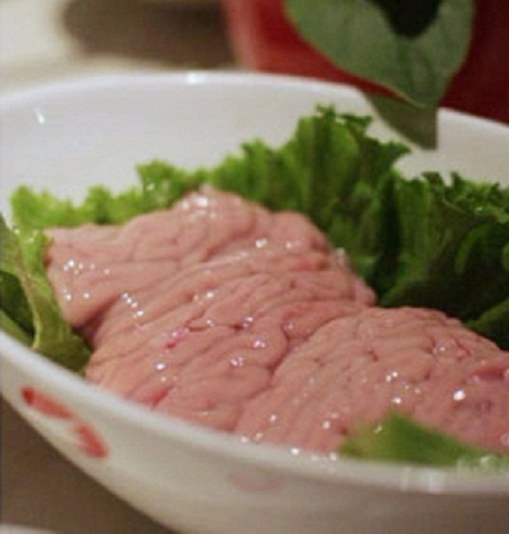 viêm mũi dị ứng