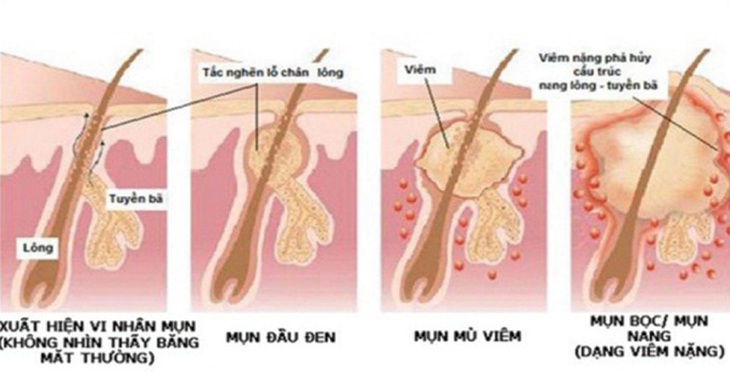 Các bệnh về da thường gặp