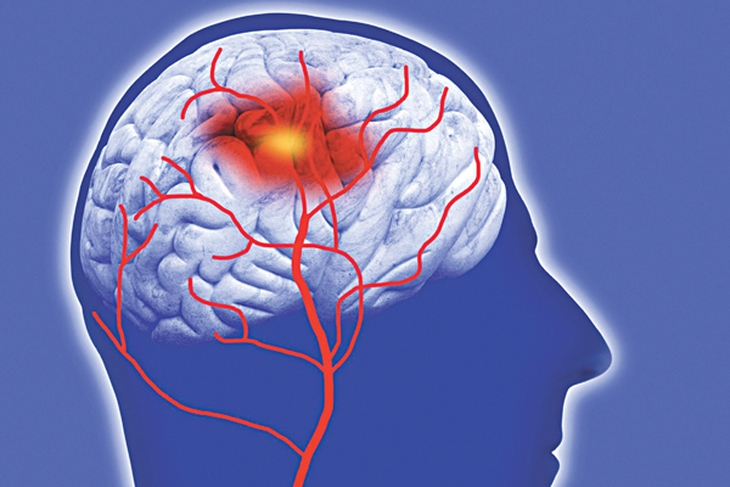 Ai dễ mắc máu nhiễm mỡ?