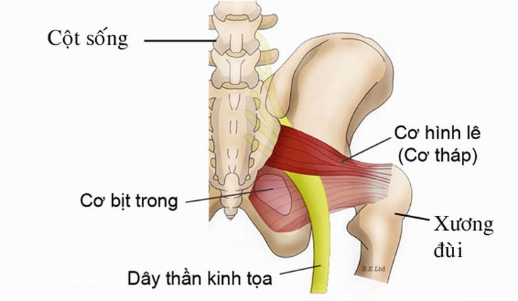 Ðau thần kinh tọa do... ví dày