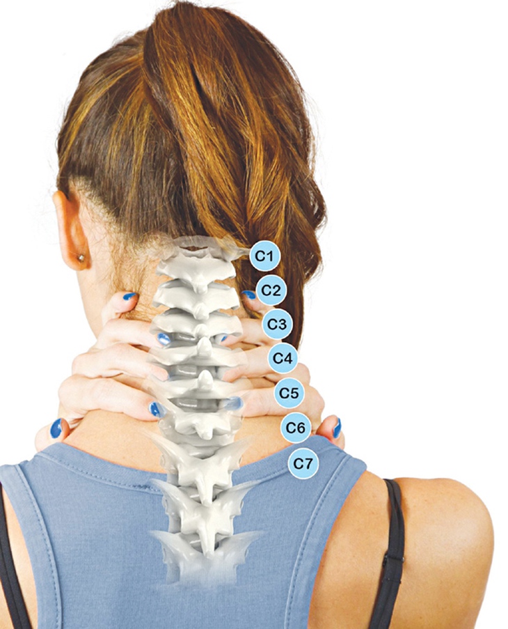 Biến chứng do thoái hóa đốt sống cổ